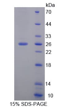 Human FAM3D Protein (Recombinant His-T7)