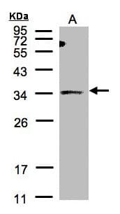 ST3GAL1 Antibody (aa1-195)