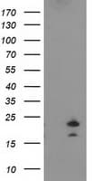 FGF21 Antibody (clone OTI1A9)