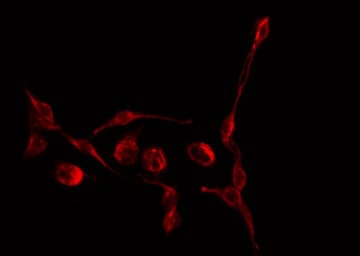 TGFB3 / TGF Beta3 Antibody