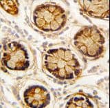 Polyclonal Rabbit anti-Human PRLTS / PDGFRL Antibody (aa328-357, IHC, WB)