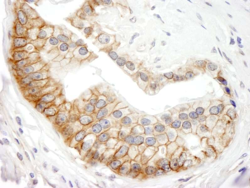 Polyclonal Rabbit anti-Human ABCB9 Antibody (aa475-525, IHC, IF)