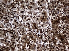 PCNA Antibody (clone OTI6A10)