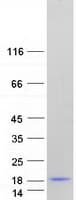 Human LGALSL / Galectin 5 Protein (Recombinant Myc-DDK (Flag))