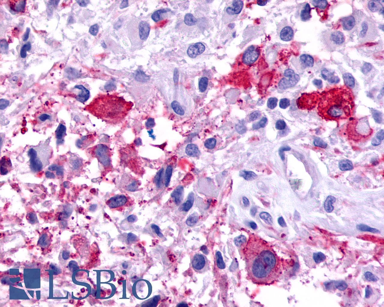 IHC-plus™ Polyclonal Rabbit anti-Human FZD2 / Frizzled 2 Antibody (N-Terminus, IHC)