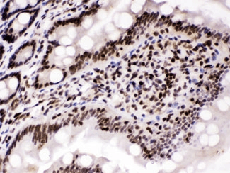 CCNT1 / Cyclin T1 Antibody