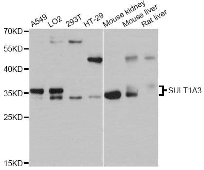 M-PST / STM Antibody