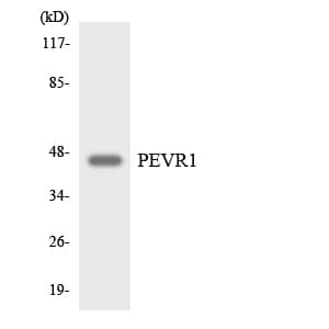Polyclonal Rabbit anti-Human SLC52A2 / GPR172A / PAR1 Antibody (aa33-82, WB)