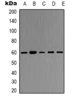 Polyclonal Rabbit anti-Human TRAF6 Antibody (Internal, IHC, WB)