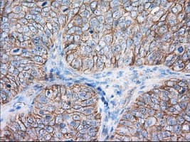 Basigin / Emmprin / CD147 Antibody (clone OTI4D3)
