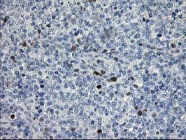 Monoclonal Mouse anti-Human STAT4 Antibody (clone OTI2F3, IHC, IF, WB)