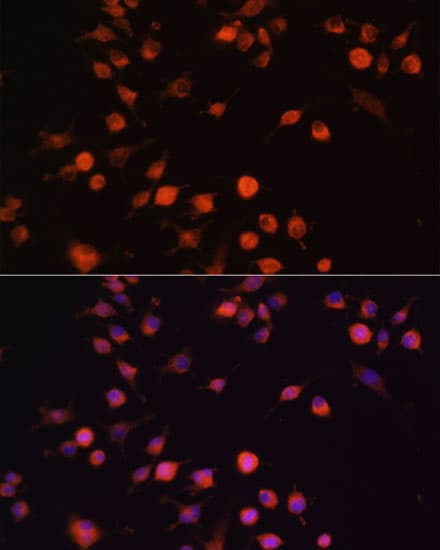 FAK / Focal Adhesion Kinase Antibody