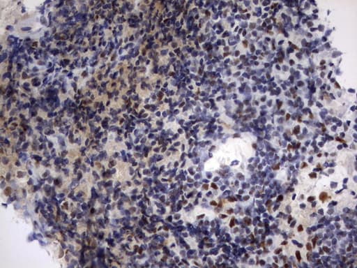 PARN Antibody (aa1-266, clone UMAB143)