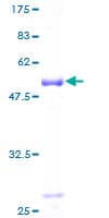 Human RNF114 / ZNF313 Protein (Recombinant GST)