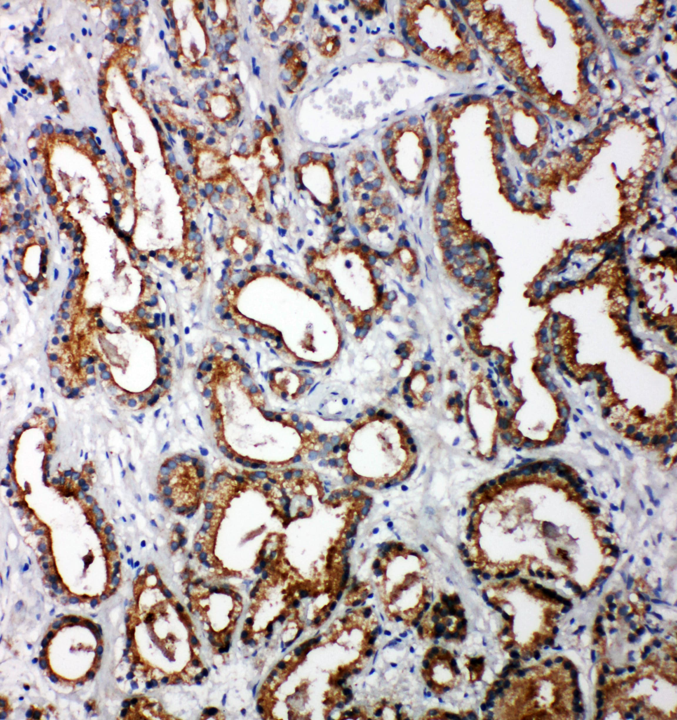 Polyclonal Rabbit anti-Human TOLLIP Antibody (aa224-243, IHC, WB)