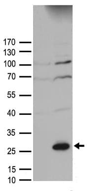 SOCS1 Antibody