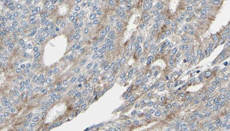 MARCKS Antibody