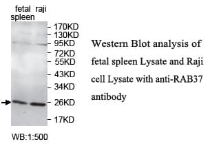 RAB37 Antibody (aa31-219)
