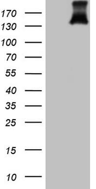 PDGFRA / PDGFR Alpha Antibody (aa789-1089, clone OTI4G5, Carrier-free)