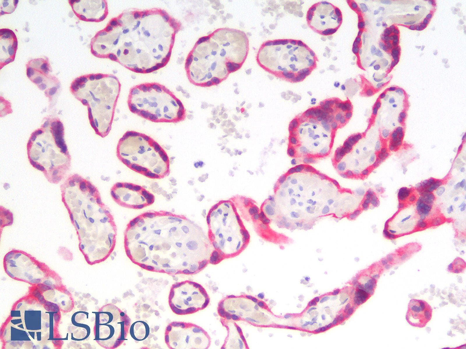 PathPlus™ BCL2 / Bcl-2 Antibody (clone rBCL2/796)