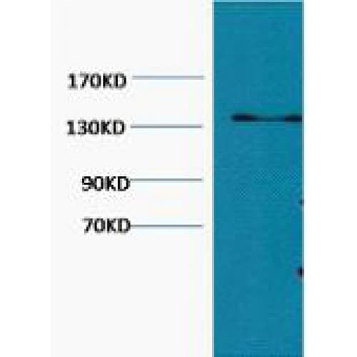 Collagen III Antibody (clone Q76)
