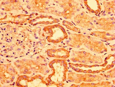 ACOT1 Antibody