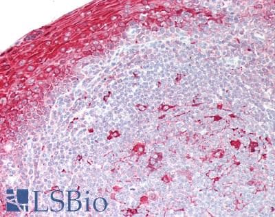 IHC-plus™ LRAT Antibody (Internal)