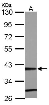 ZNF707 Antibody (aa121-371)