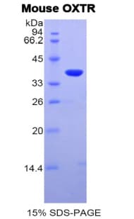 Mouse OXTR / Oxytocin Receptor Protein (Recombinant His-GST)