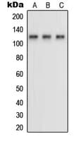 Polyclonal Rabbit anti-Human NRP1 / Neuropilin 1 Antibody (Internal, WB)