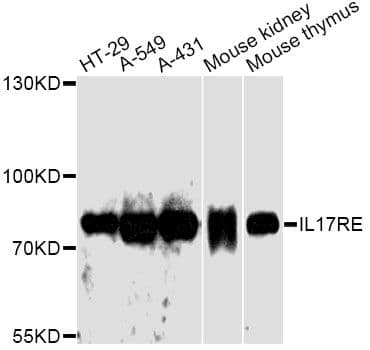 Polyclonal Rabbit anti-Human IL17RE Antibody (WB)