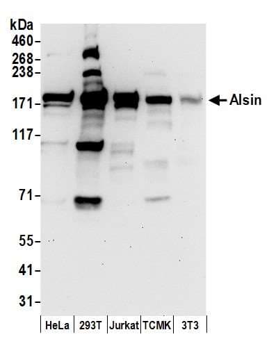 ALS2 / Alsin Antibody (aa1250-1300)