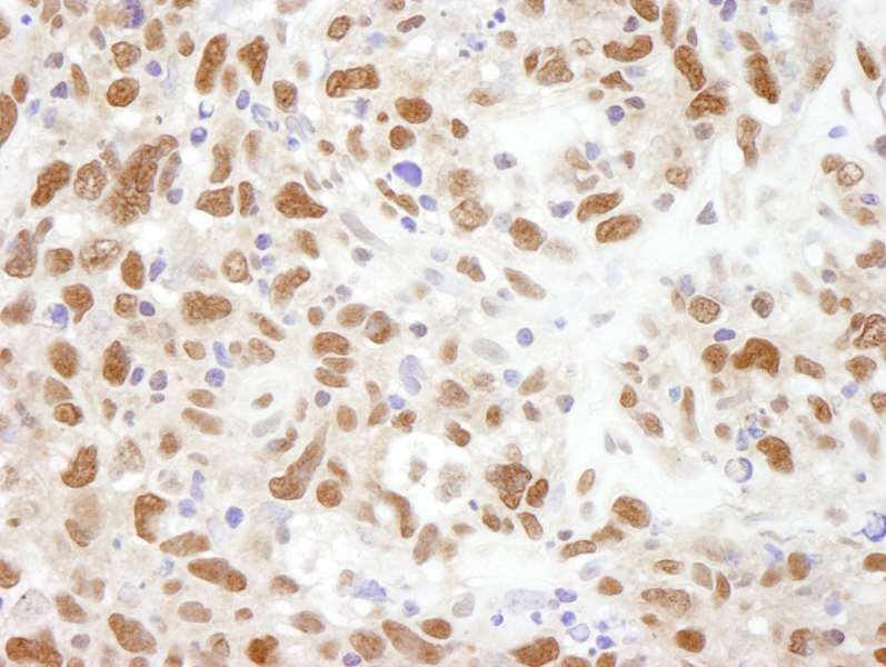 Polyclonal Rabbit anti-Human BUB3 Antibody (aa275-325, IHC)