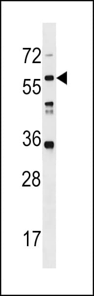 Polyclonal Rabbit anti-Human LRRC14B Antibody (aa55-81, WB)