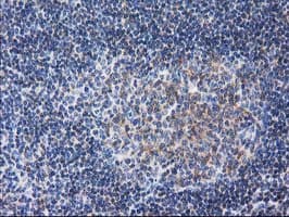 RTN4IP1 / NIMP Antibody (clone OTI3B2)