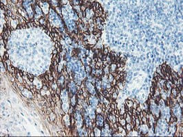 FXYD3 Antibody (clone OTI1F12)