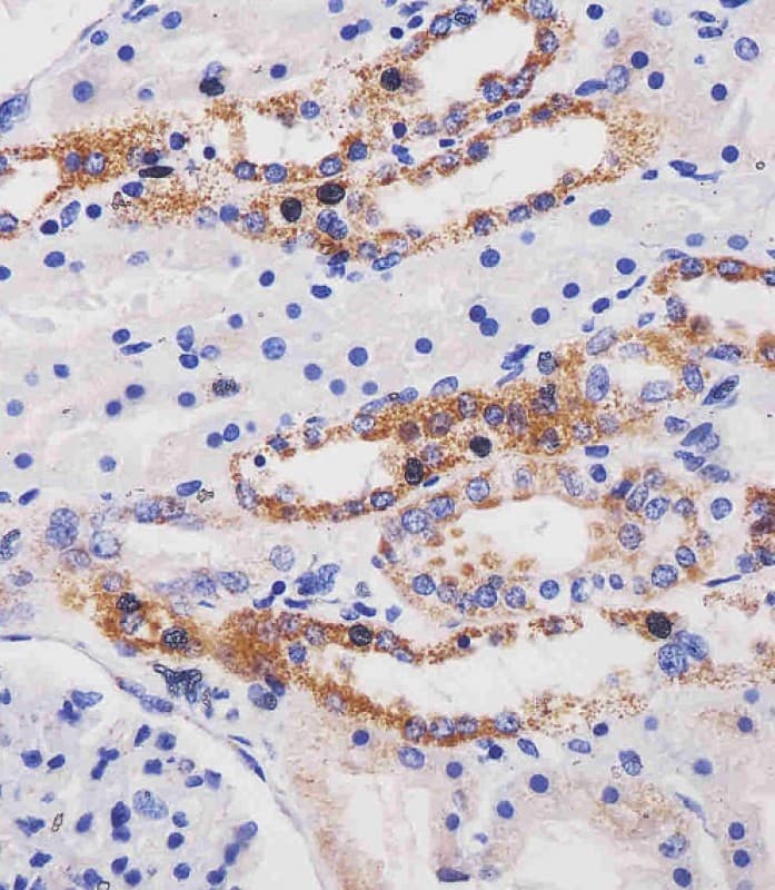 Monoclonal Mouse anti-Human ME2 / Malate Dehydrogenase 2 Antibody (clone 970CT2.1.1.2, C-Terminus, IHC, WB)