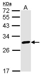 CALB2 / Calretinin Antibody
