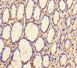 Polyclonal Rabbit anti-Human WDR54 Antibody (WB)