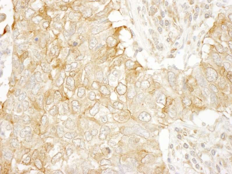 SASH1 Antibody (aa750-800)