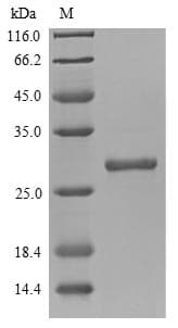 Mouse CELA3B / ELA3B Protein (Recombinant 6His, N-terminus + Myc, C-terminus)