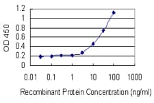 Monoclonal Mouse anti-Human ID4 Antibody (clone 3F11, WB)