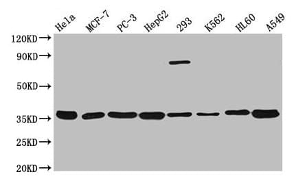 ANXA5 / Annexin V Antibody (aa2-320)