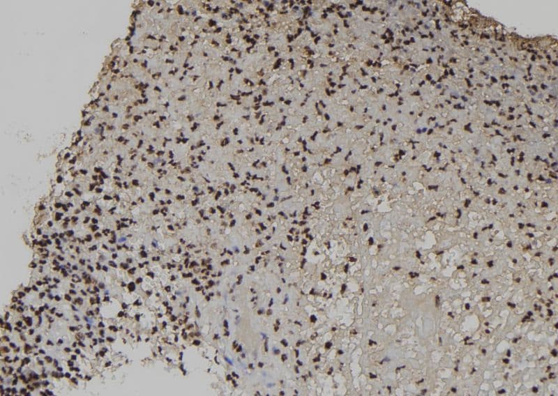 EXOSC3 Antibody
