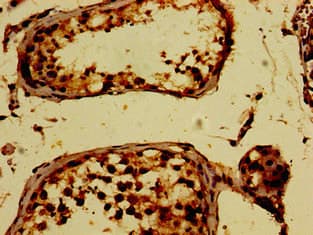 PKD2 / Polycystin 2 Antibody