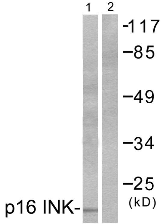 p16INK4a / CDKN2A Antibody
