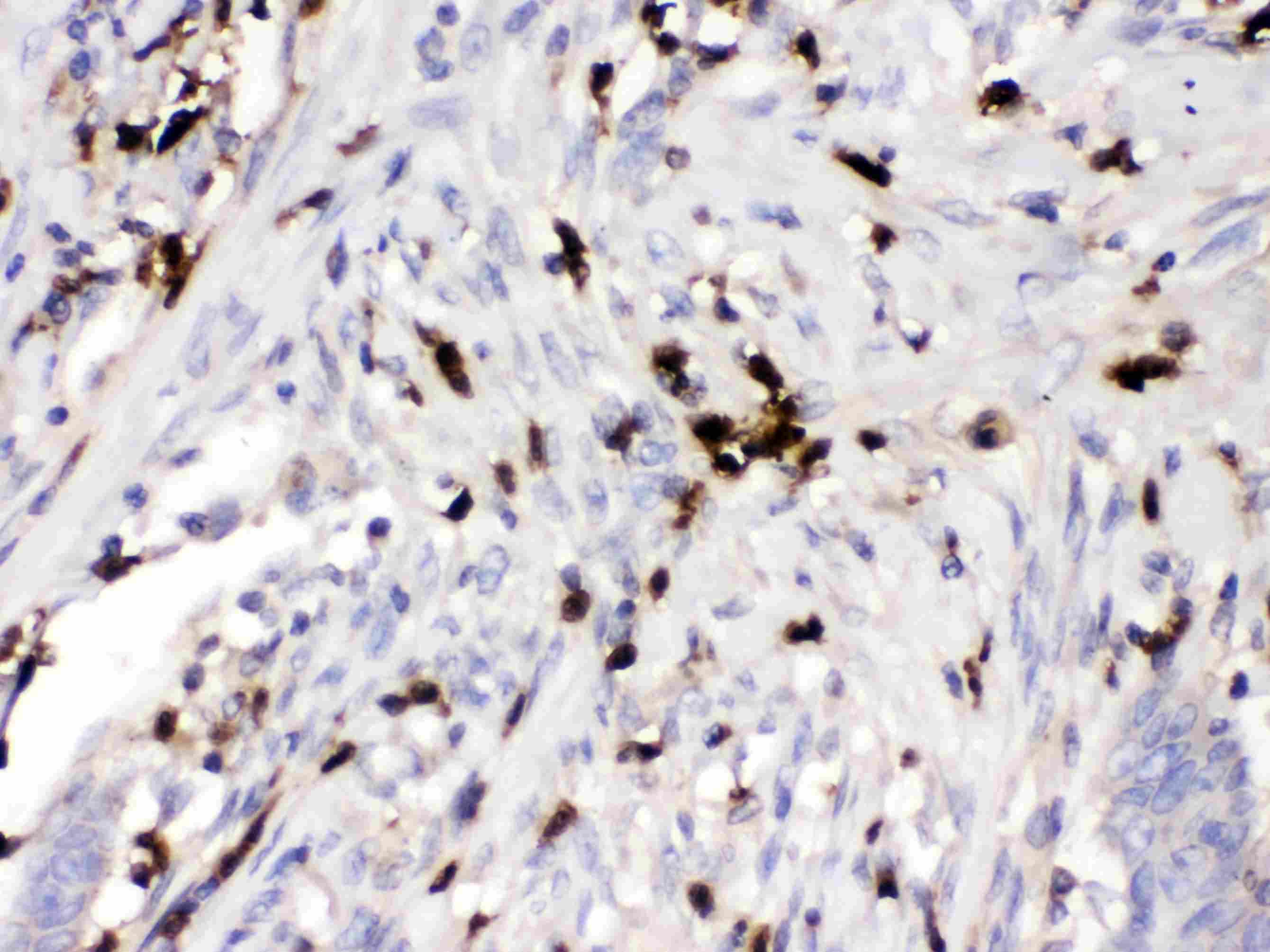 Polyclonal Rabbit anti-Human ORM1 / Orosomucoid Antibody (IHC, WB)