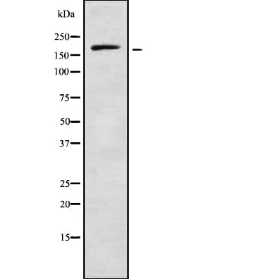 Polyclonal Rabbit anti-Human RREB1 Antibody (WB)