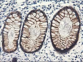 NAPE-PLD Antibody (clone OTI7B9)