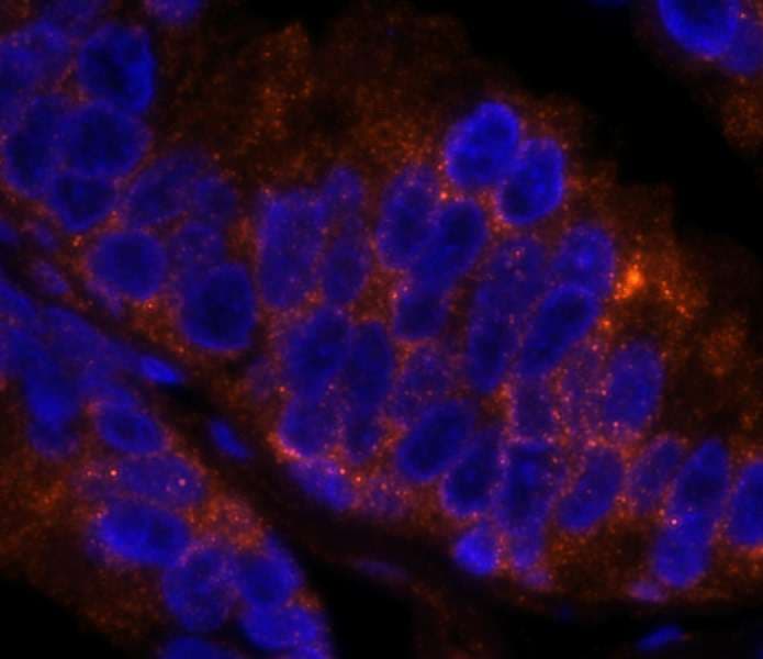 Polyclonal Rabbit anti-Human EIF4ENIF1 / 4E-T Antibody (aa925-C-term, IHC, IF)